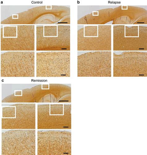 Immunohistochemical staining for myelin-basic-protein (MBP) to assess... | Download Scientific ...