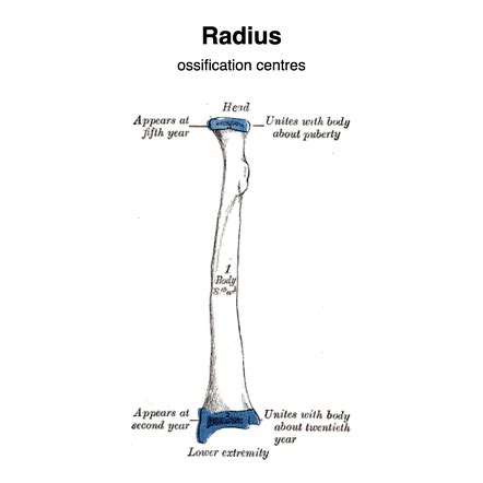 Radius Bone Labelled : Bones Teaching Resources - Anatomy standard ...