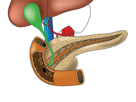 Ampullary cancer – Causes, Symptoms, Treatment and Risk factors