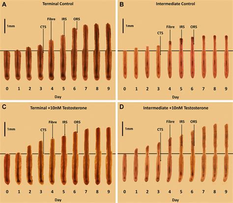 Testosterone stimulates the growth of intermediate hair follicles in ...