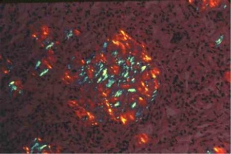 Congo Red - Histotechnology Group DST Project