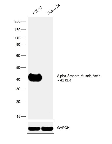 Alpha-Smooth Muscle Actin Antibody (14-9760-82)