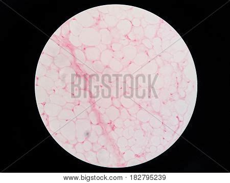 Human Fat Body Tissue Image & Photo (Free Trial) | Bigstock