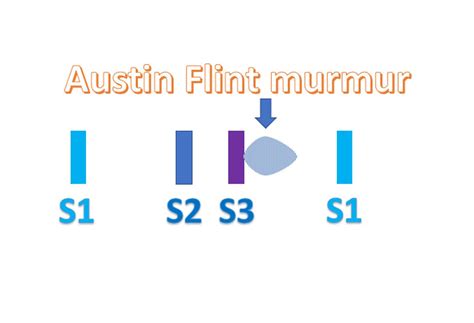 Austin Flint murmur – All About Cardiovascular System and Disorders