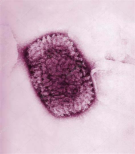 Cowpox virus — Stock Photo © imagepointfr #44394385