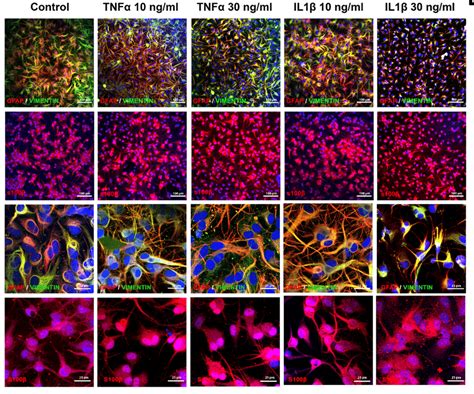 Exposure to cytokines induces morphological modifications in human ...