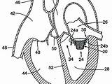 Pulmonary Circulation Coloring Page Sketch sketch template
