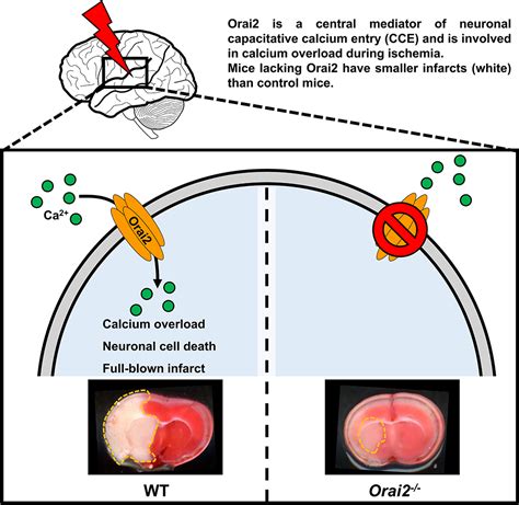 Loss of Orai2-Mediated Capacitative Ca2+ Entry Is Neuroprotective in Acute Ischemic Stroke | Stroke