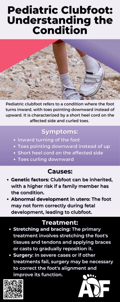 Complete Overview of Club Foot: Causes, Symptoms, Treatments