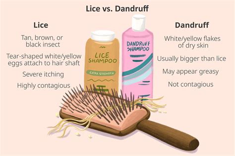 Telling the Difference Between Lice and Dandruff (2022)