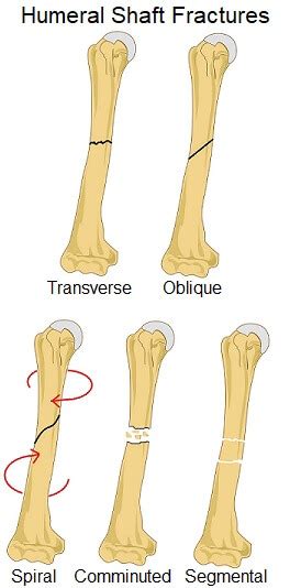 Humeral Anatomy - Anatomy Reading Source