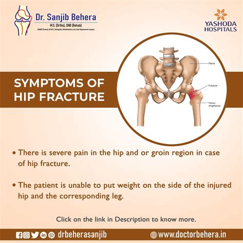 Symptoms of Hip Fractures. | Hip fracture, Orthopedics, Symptoms