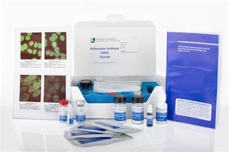 In-Vitro Diagnostic Kits – Antibodies Incorporated