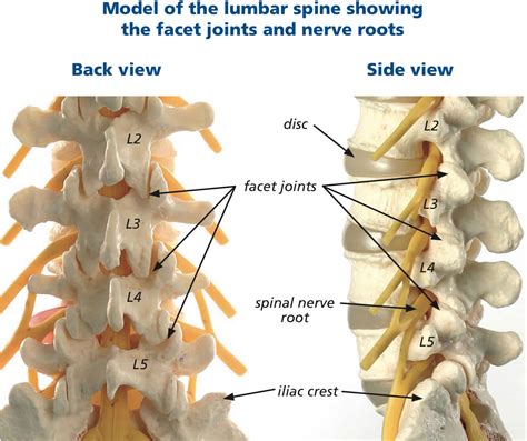 Lumbar Facet Joint Arthritis