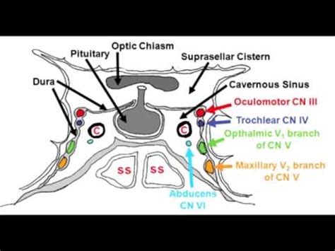 Cavernous Sinus Anatomy & Cavernous Sinus Syndrome - YouTube