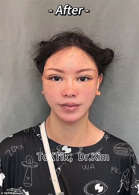 'If this is real, you screwed up': Social media goes wild over TikTok doctor's 'scary' before ...