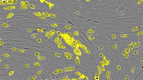 Mitochondrial Membrane Potential Assay | Sartorius