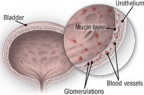 Bladder Pain Female