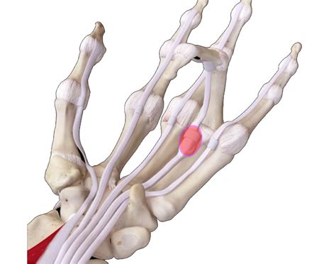 Trigger Finger-causes, symptoms and treatments | Orthopaedics Corner ...