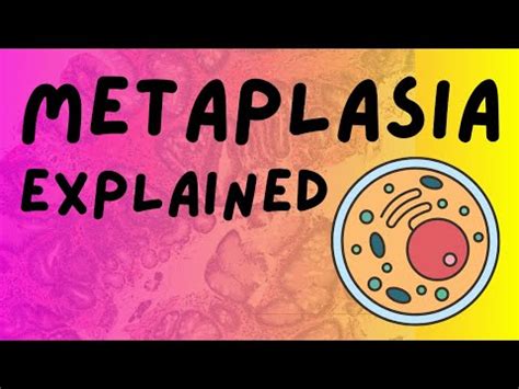 Intestinal Metaplasia of the Stomach | Doovi