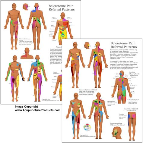 Sclerotome and Visceral Pain Chart