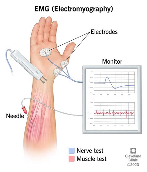 Emg Test Neck