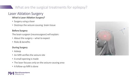 Can Epilepsy Surgery Help? - Surgical Treatments for Epilepsy - YouTube