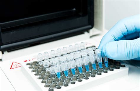 DNA/RNA oligo synthesis services