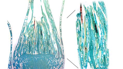 ‎Mnium moss - longitudinal section through the apex of a female gametophyte - composite of the ...