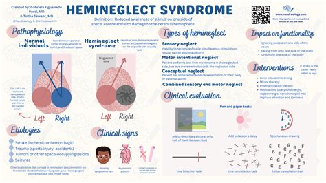 Hemineglect syndrome — Neudrawlogy: Simplifying Neurology