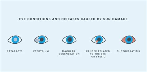 How Does the Sun Damage Our Eyes? | Warby Parker