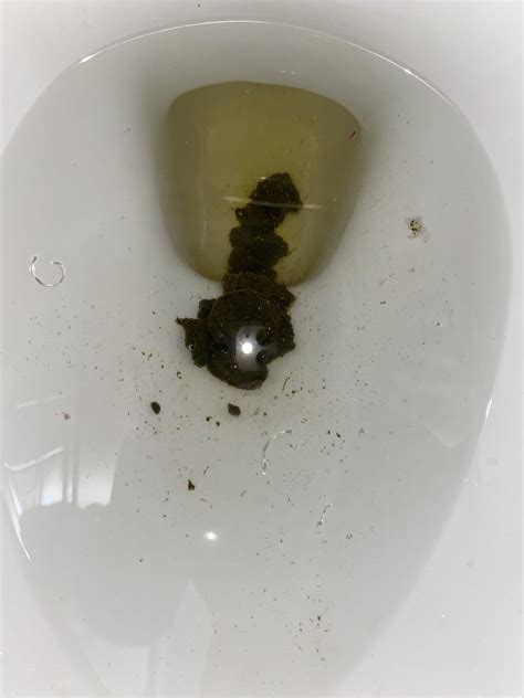 Very Dark green poop/Diarrhea. Stomach gurgling. Should I be worried? : r/ibs