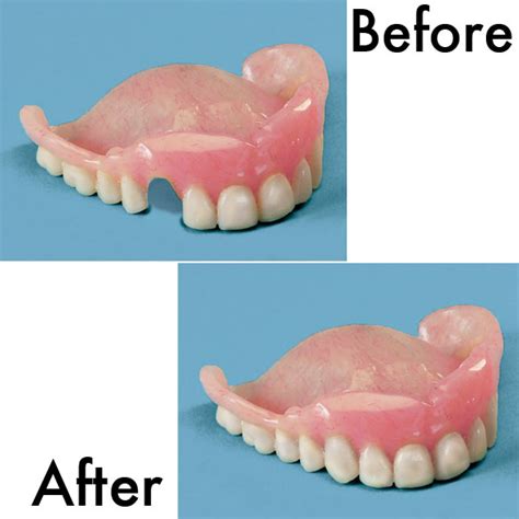 Denture Repair: Walgreens Denture Repair Kit