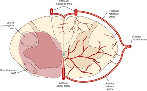 Anterior spinal artery syndrome | Medicine Specifics