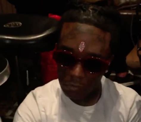 Lil Uzi Vert Explains How Diamond In His Forehead Could Kill Him