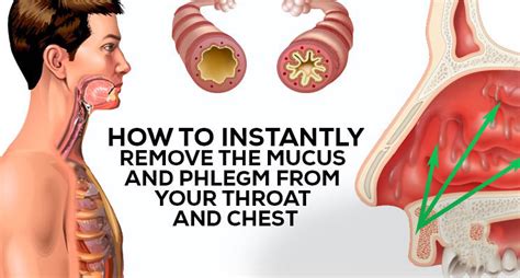 How to Get Rid of Phlegm and Mucus in Chest & Throat - Hecspot