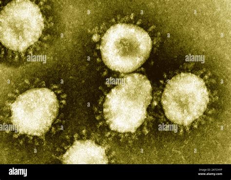 Electron microscopy hi-res stock photography and images - Alamy
