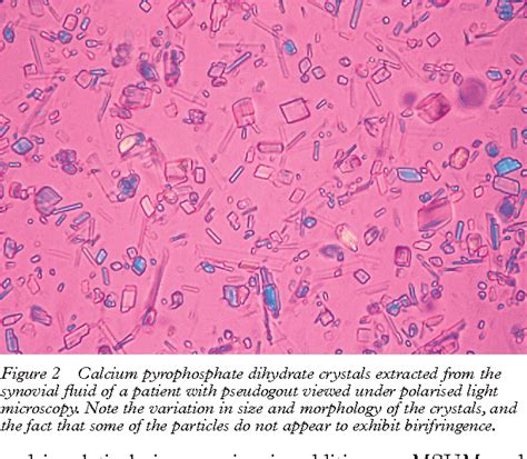 [PDF] Leader Identification of crystals in synovial fluid | Semantic Scholar