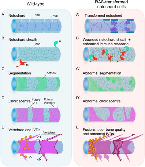 Pre-neoplastic notochord cells drive abnormal vertebral column development | Download Scientific ...