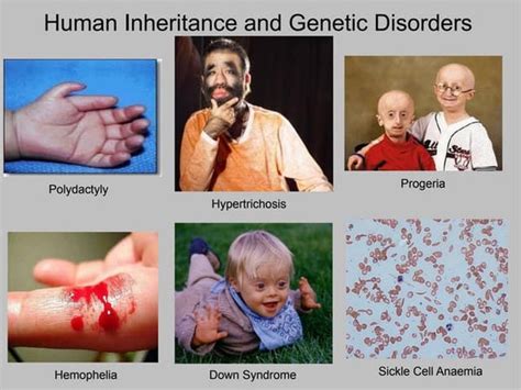 Genetic disorders