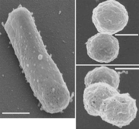 23 Interesting Facts about Halobacterium Salinarum - World's Facts