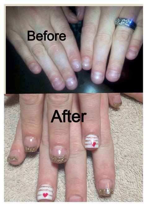 Acrylic nails, before and after, natural nails, nail design, glitter tips Love Nails, Nail Arts ...