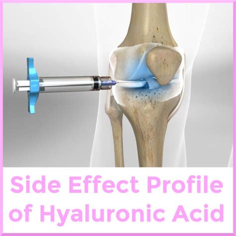 Side Effects of Intra-Articular Knee Hyaluronic Acid Injection - Sports ...