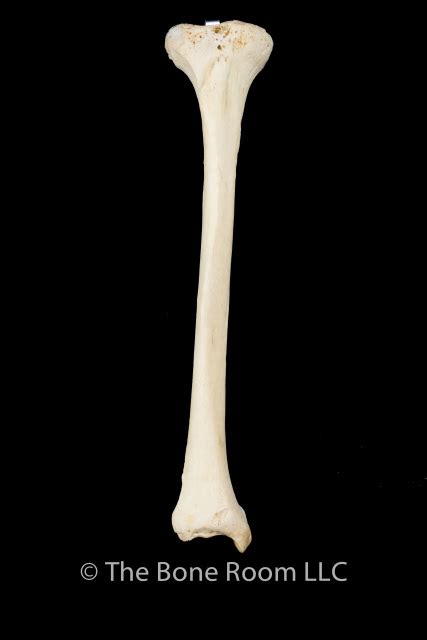 Anatomical Human Tibia Bone Model Left And Right Medical Leg Skeleton ...