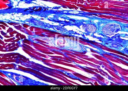 Pork worm larvae (Trichinella spiralis) in a muscular tissue. Optical ...