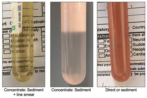 Lymph Fluid Sample