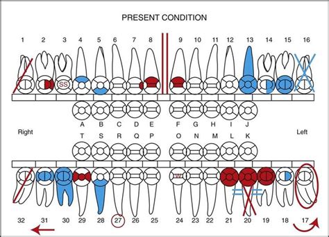 Patient records management dental charting. The is for present dental status and work already ...