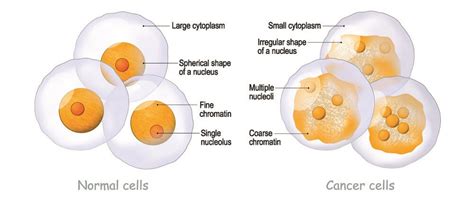 Cancer Cell - The Definitive Guide | Biology Dictionary