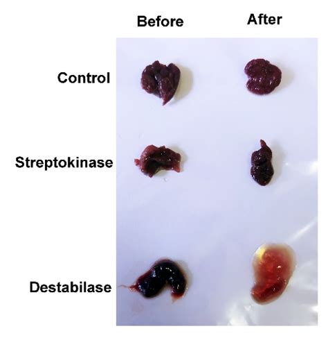 CIMB | Free Full-Text | Recombinant Destabilase from Hirudo medicinalis Is Able to Dissolve ...