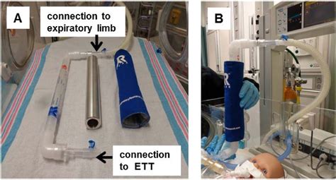 Exhaled breath condensate in intubated neonates- a window into the lung ...